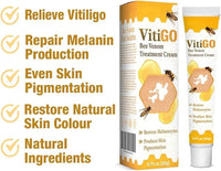 Bee Venom Vitiligo Cream 20g – Melanin Care Ointment
