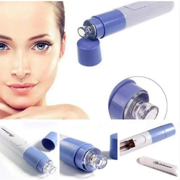 Electric Blackhead Remover Vacuum (Random Color)