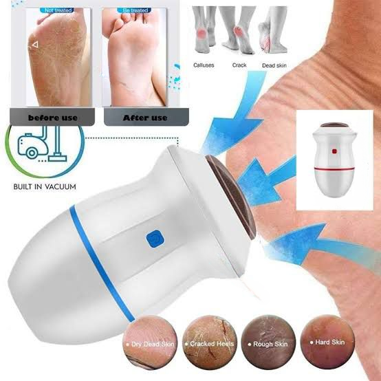 Rechargeable Electric Callus Remover with Vacuum